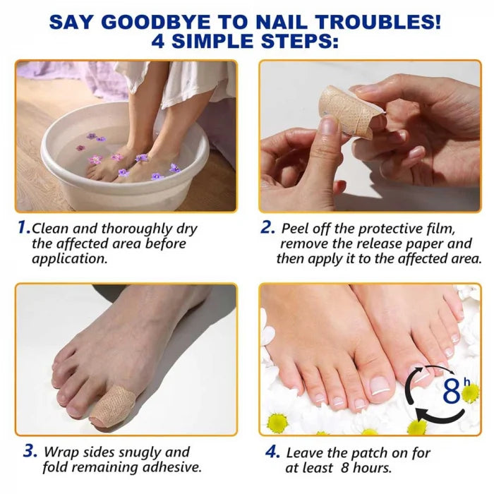 21 Plasturi NailHeal™ Pentru Ciuperca Unghiei